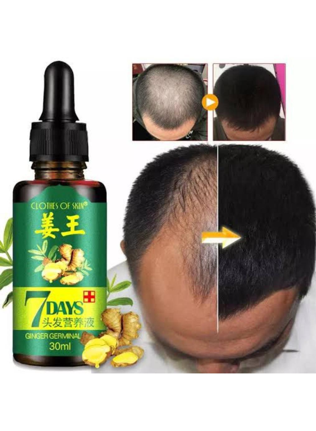 7 Day Hair Growth Serum| Ginger Hair Nutrient Solution 30ML