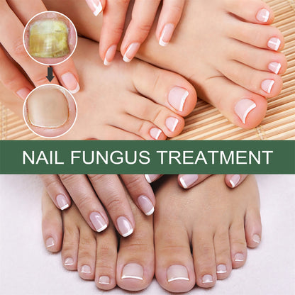 Anti-Fungus Nail Treatment