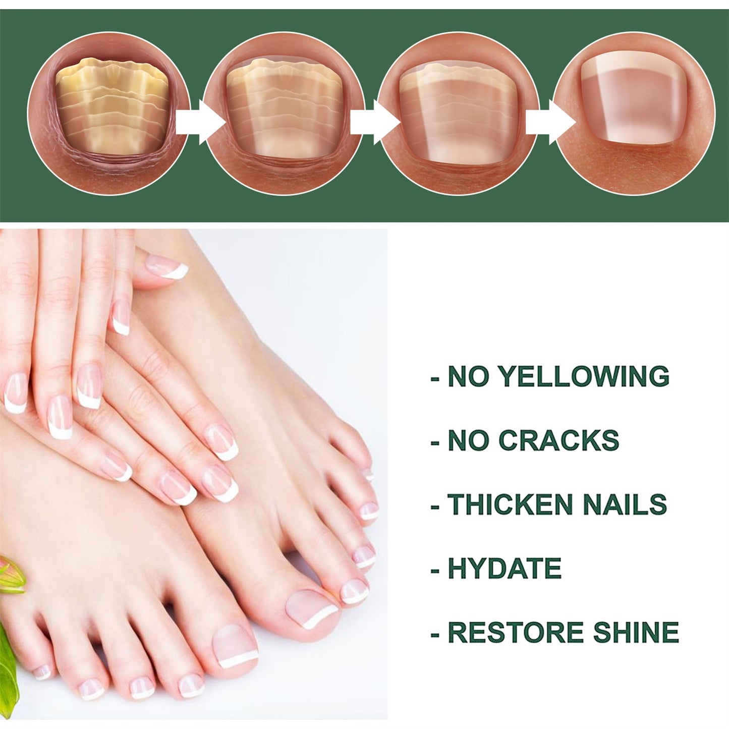 Anti-Fungus Nail Treatment