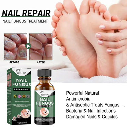 Anti-Fungus Nail Treatment