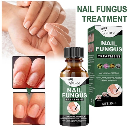 Anti-Fungus Nail Treatment