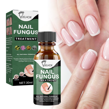 Anti-Fungus Nail Treatment