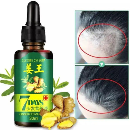 7 Day Hair Growth Serum| Ginger Hair Nutrient Solution 30ML