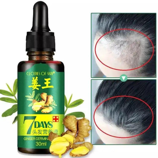 7 Day Hair Growth Serum| Ginger Hair Nutrient Solution 30ML